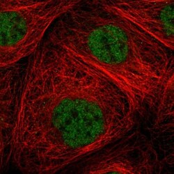 ZNF354B Antibody, Novus Biologicals 25 &mu;L | Buy Online | Novus Biologicals | Fisher Scientific